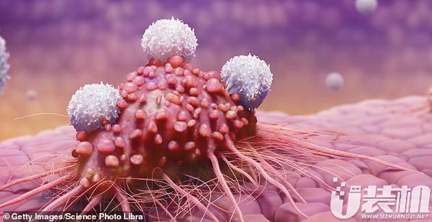 科学家提出利用陌生人免疫细胞的一种创新癌症疗法
