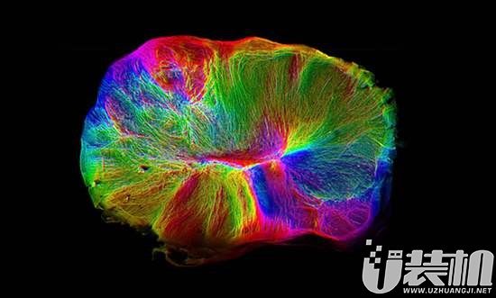科学家培育出“迷你”大脑，有望加快对运动神经元疾病的研究